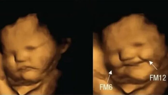 475898034_1038550501652721_2574128721618615394_n