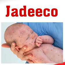 Mid kamid ah dhaqaatiirta Baladweyne oo ku baaqay in laga digtoonaado cudurka Jadeecada