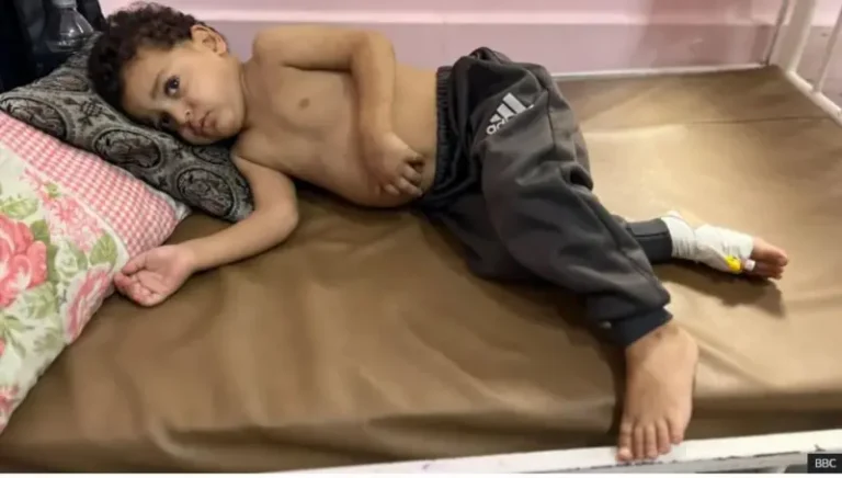 Carruurta Qasa oo dhimanaya xilli Israa’iil laga sugayo oggolaanshaha in dibadda lagu daaweeyo